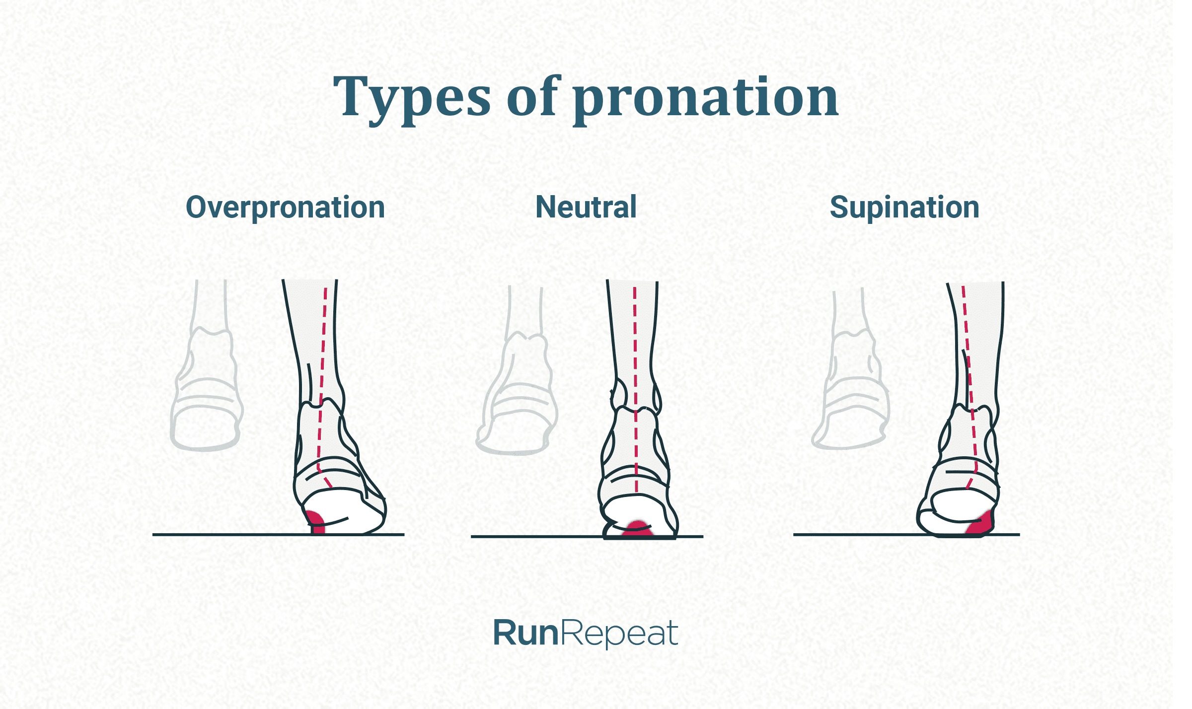 overpronation-illustration-runrepeat.jpg