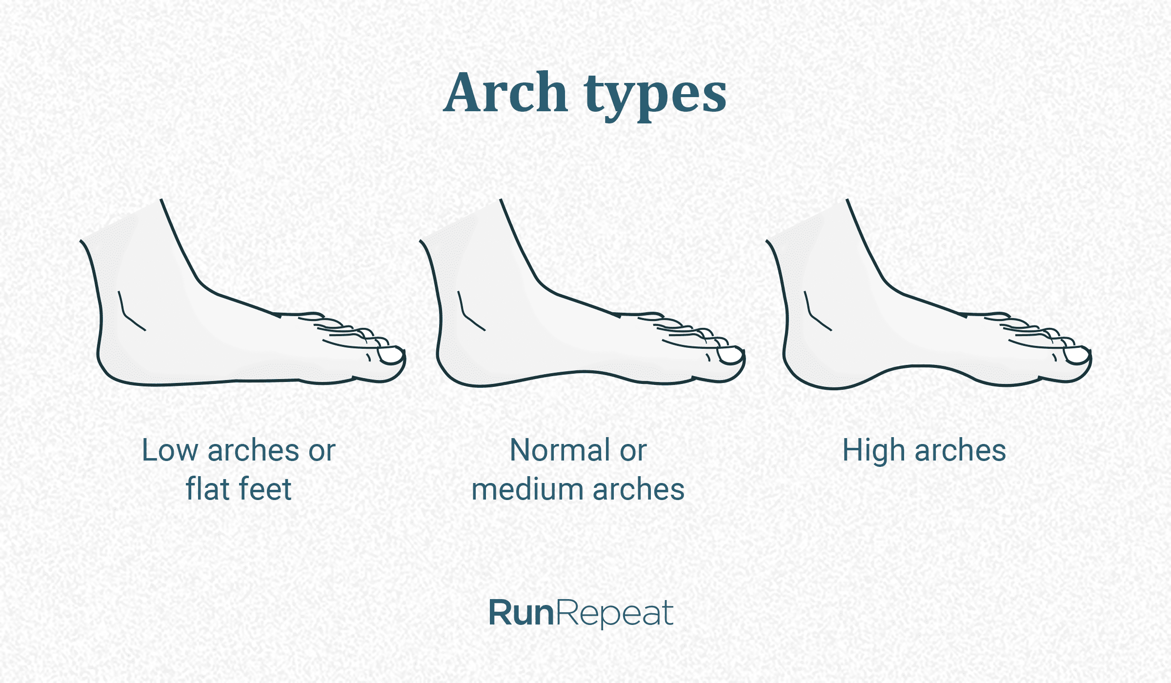 Flat feet, high arches and normal arches