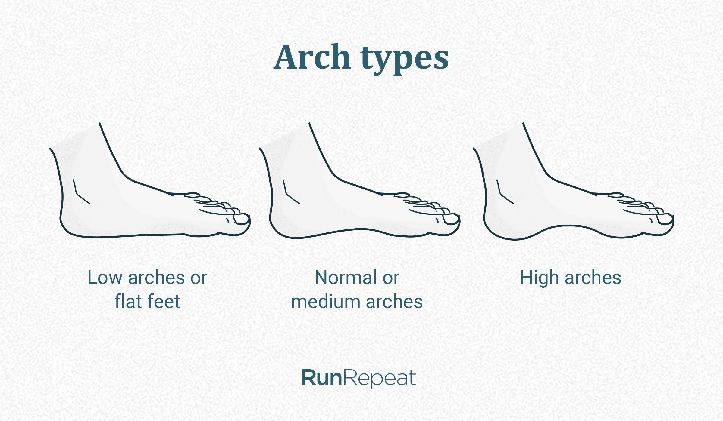 different-arch-heights-achilles-pain-running-shoes.jpg