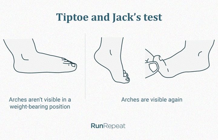 tiptoe-and-jack-test-for-flexible-flat-feet.jpg