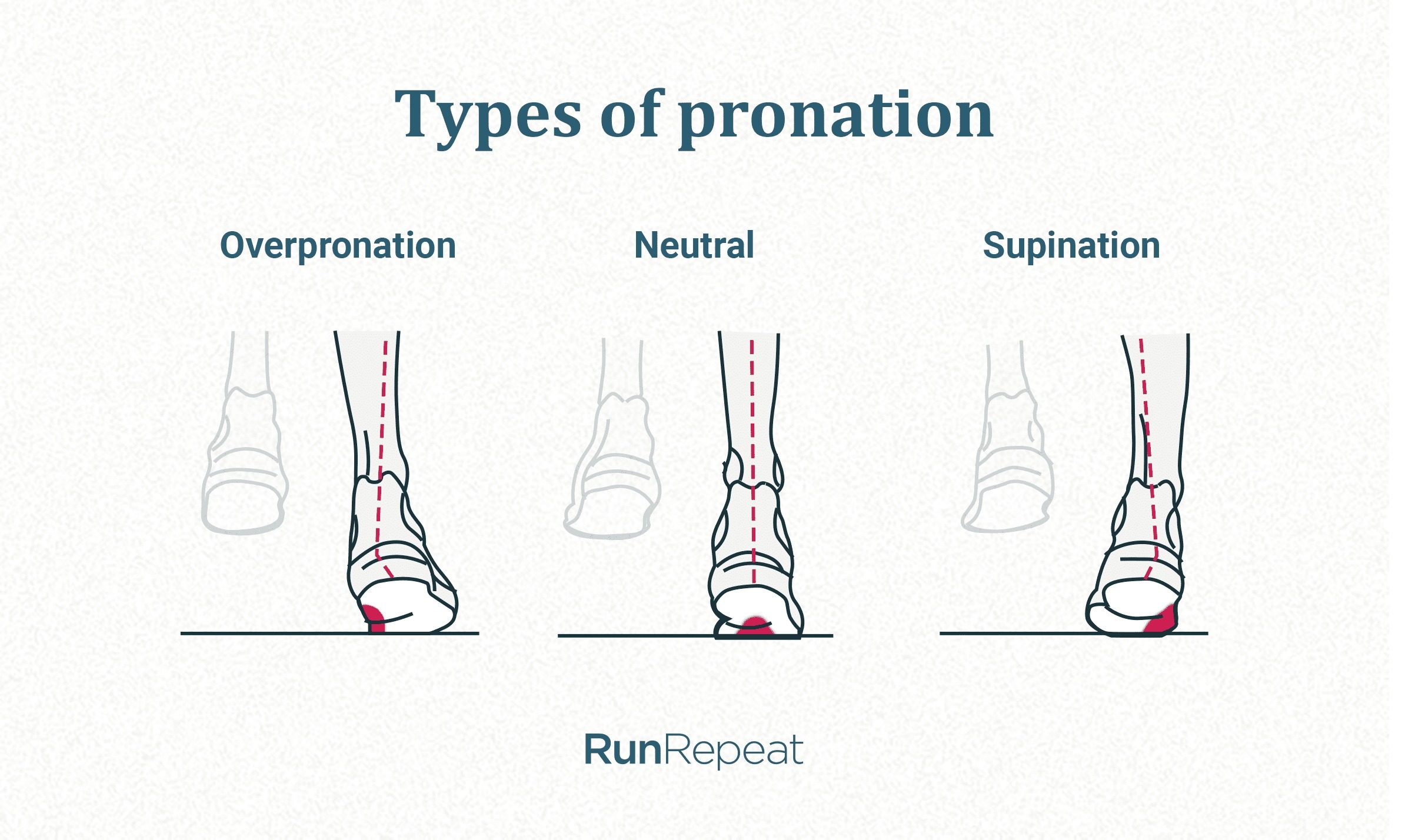 overpronation-underpronation-sup.jpg