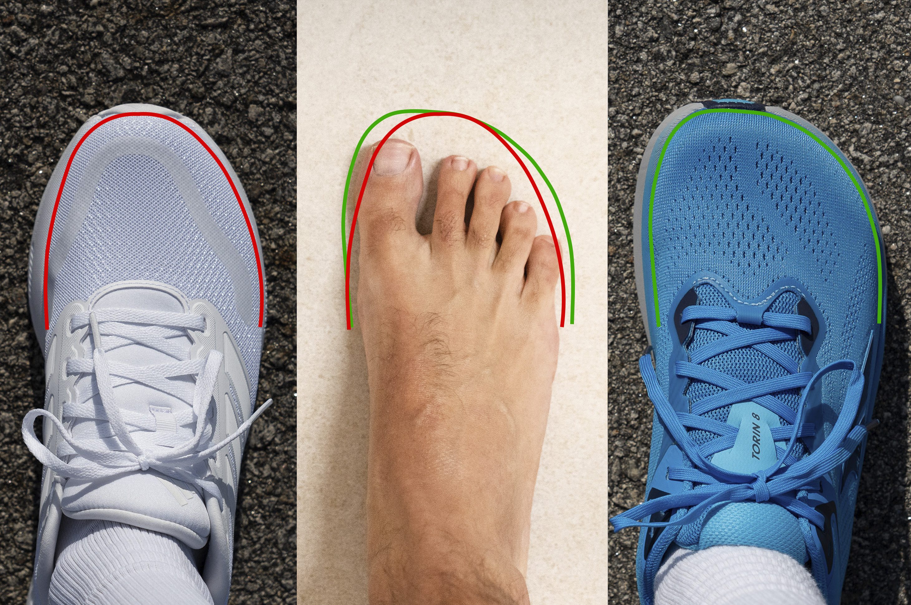 pointy shoe vs foot-shaped shoe for bunions