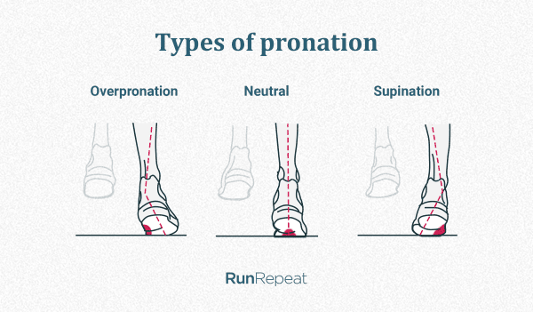 mild pronation