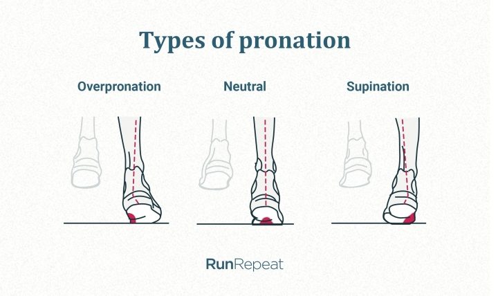 pronation-types-illustration.jpg