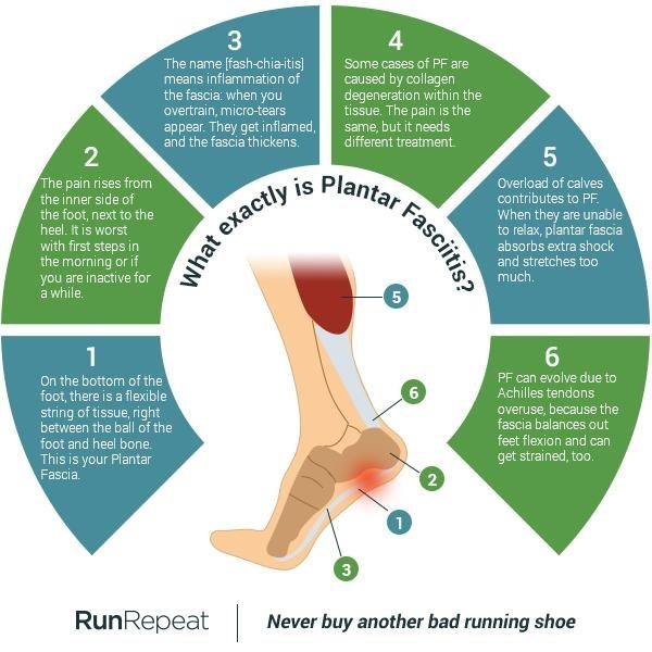 50 Shades of Plantar Fasciitis (Ultimate Guide) | RunRepeat