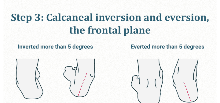 Calcaneal Peter and eversion