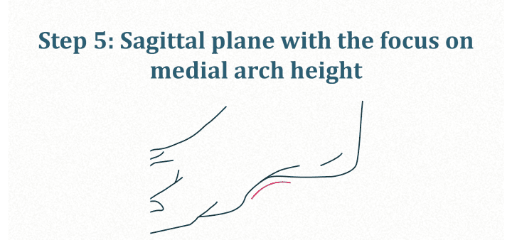 Plano sagital: altura del arco medial