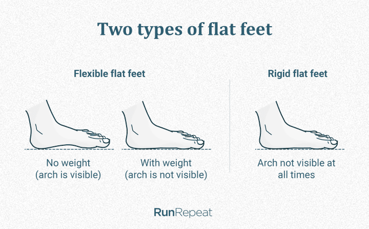 Flexible and rigid flat feet