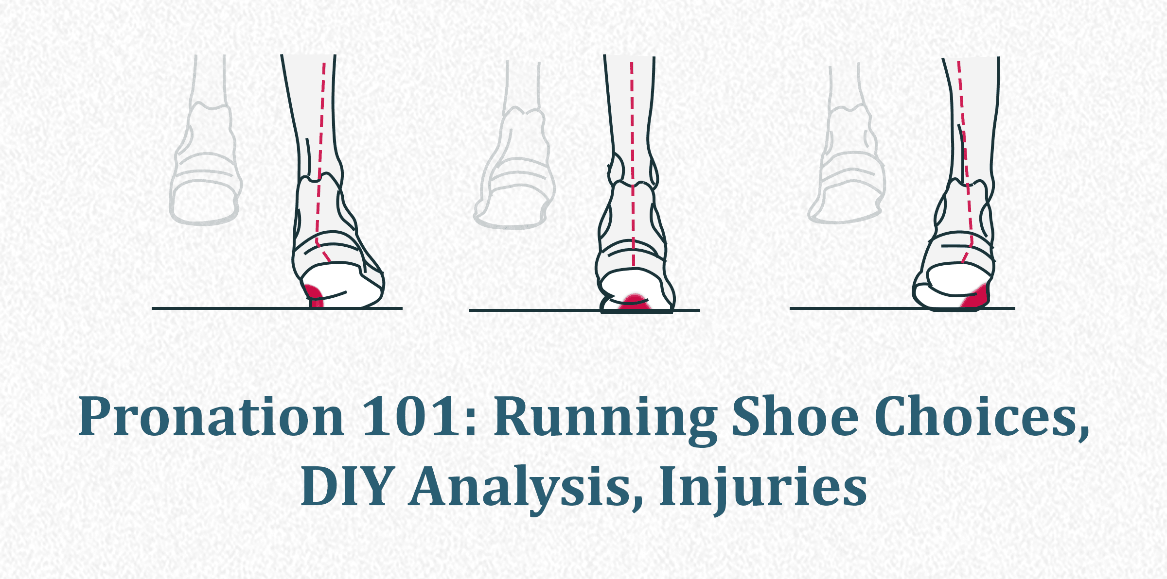 Pronation 101: Running Shoe Choices 